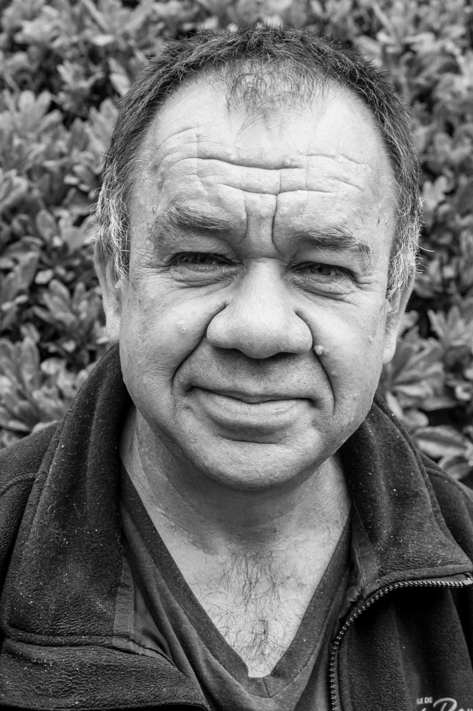 Didier implant cochléaire